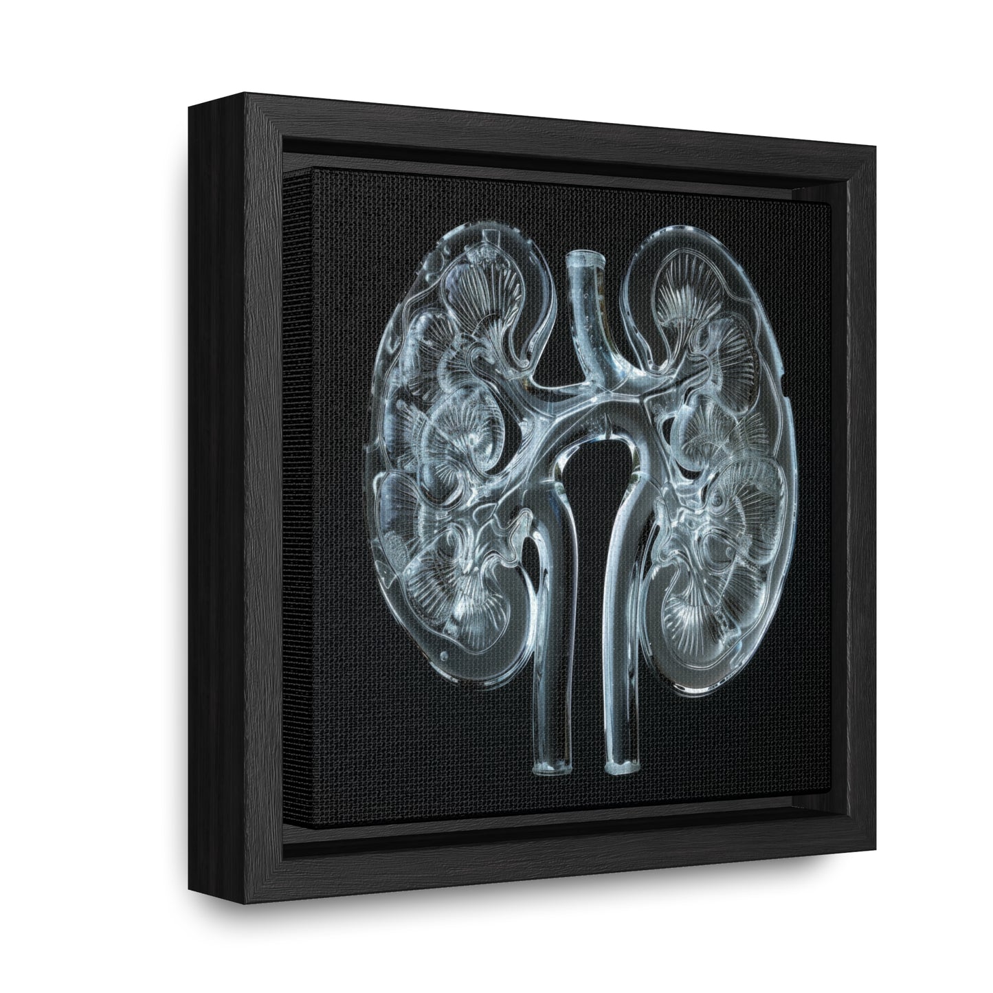 Framed Canvas - Glass Kidneys