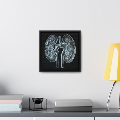 Framed Canvas - Glass Kidneys