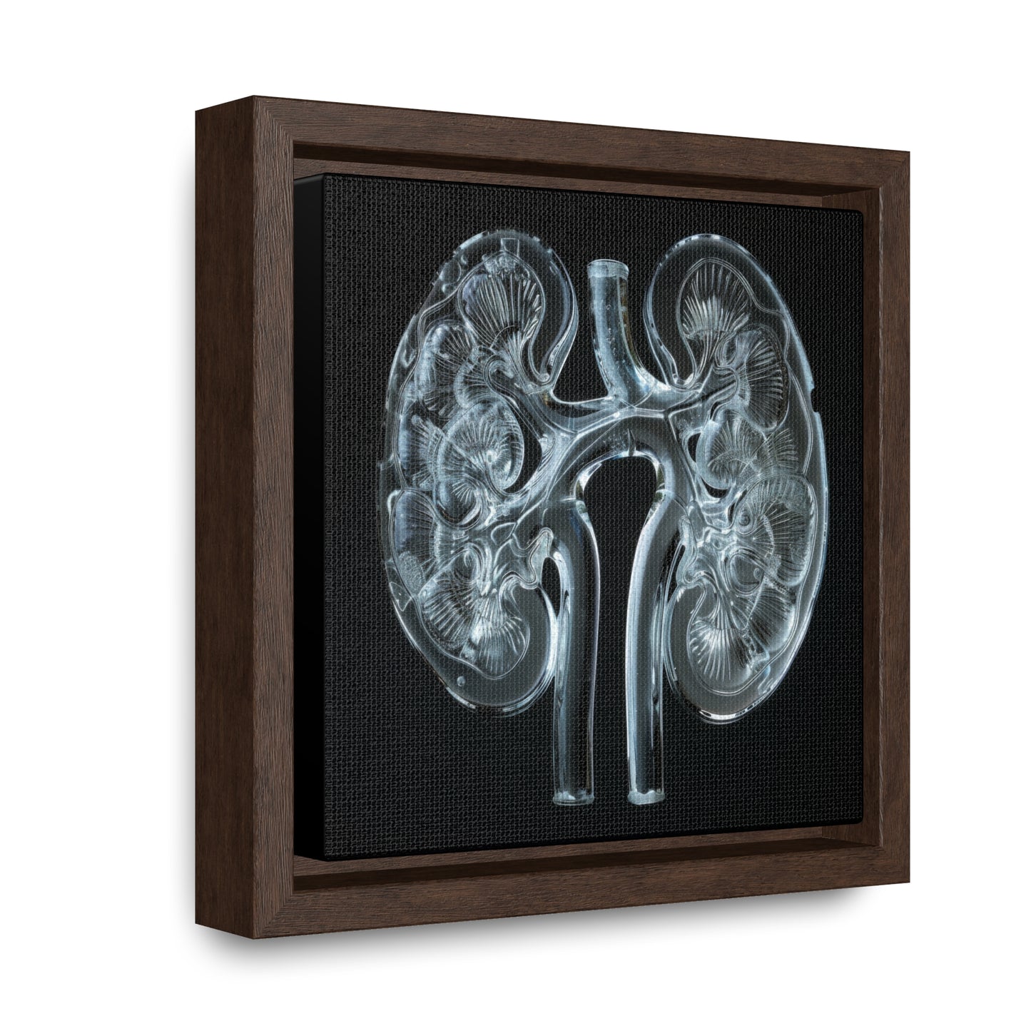Framed Canvas - Glass Kidneys