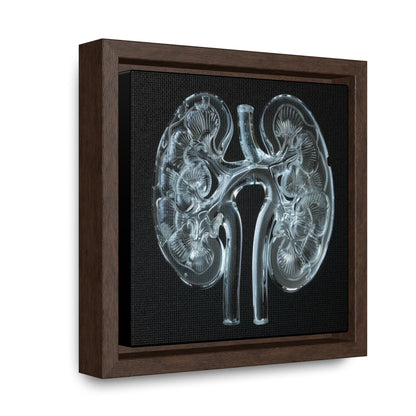 Framed Canvas - Glass Kidneys